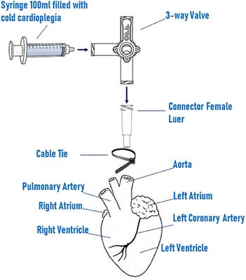 Porcine Organotypic Epicardial Slice Protocol: A Tool for the Study of Epicardium in Cardiovascular Research